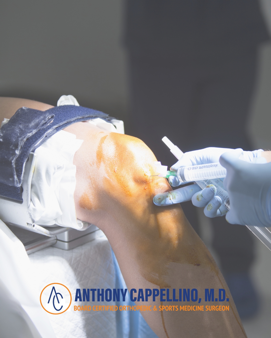 cappellino orthopedic surgeon in west babylon ny Cappellino orthopedic surgeon in west babylon ny